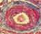 Разрез артерии под микроскопом